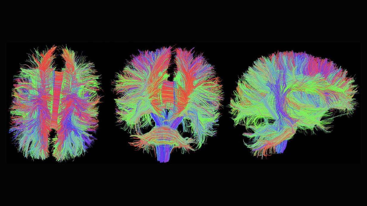 radiology brain scan, very colorful