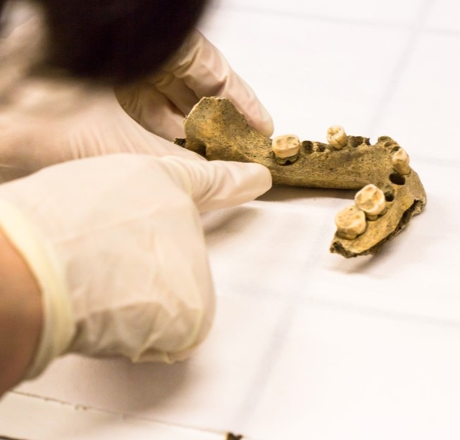 image of teeth and a scientist's gloved hand inspecting them