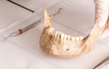 image of a human jawbone