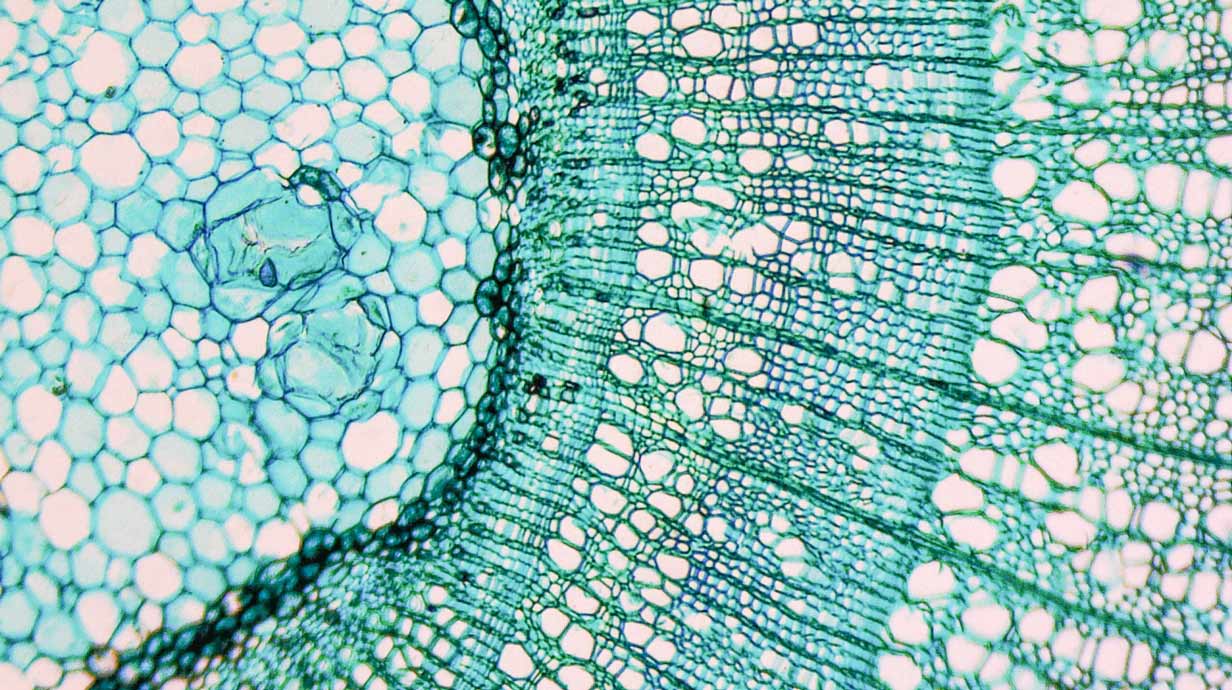 Micrograph of blue-green cells