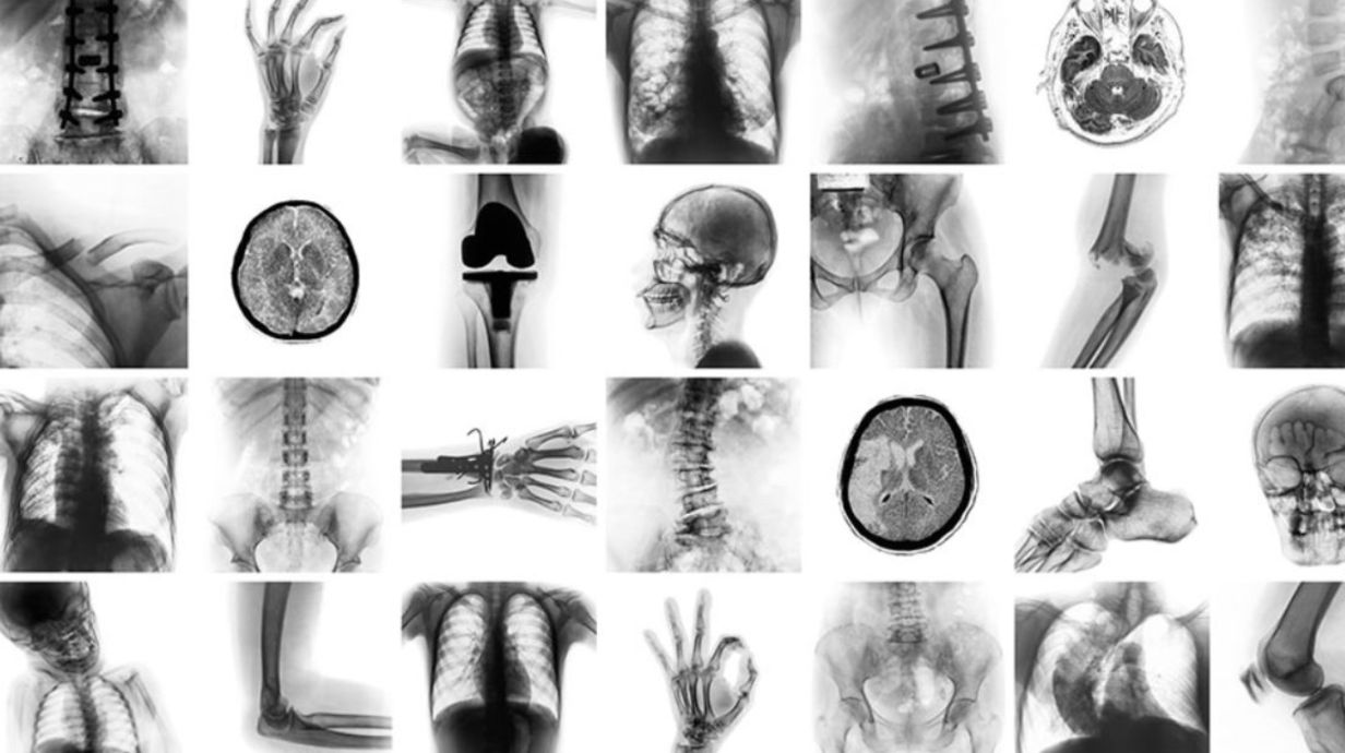 compilation of X-rays and MRIs